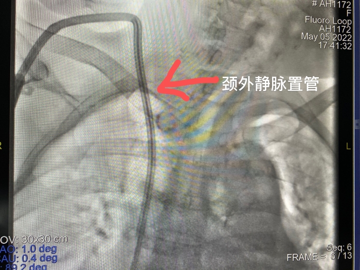 QQ圖片20220525173359 QQ圖片20220525173359