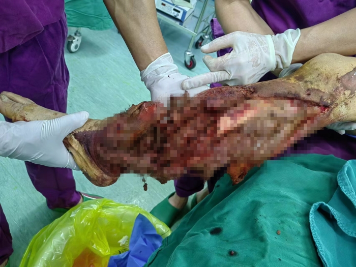 術(shù)前 術(shù)前