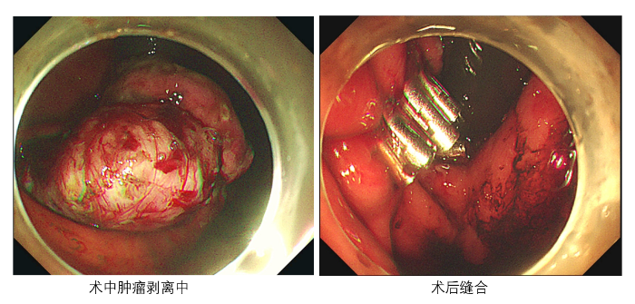 QQ截圖20240309102617 QQ截圖20240309102617