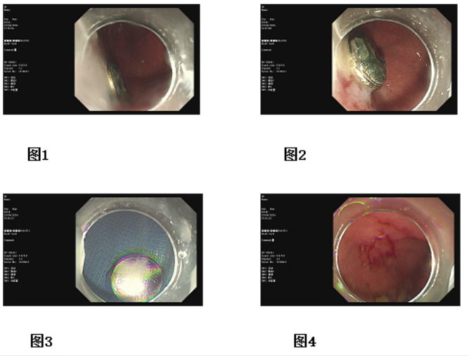 微信圖片_20240426091708 微信圖片_20240426091708